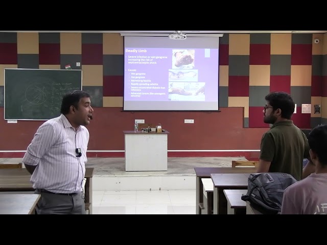 Lecture On Amputation & Limb Salvage: Indications and Surgery Guidelines | MBBS | SMCH