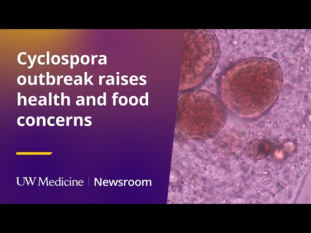 Cyclospora outbreak raises health and food concerns