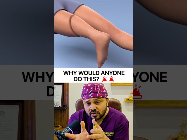 🤯Why Do Doctors Cut & Rotate the Leg? | Rotationplasty