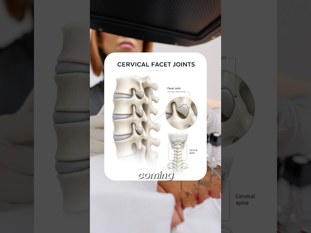 How to relieve back pain? #painmanagement #painrelief
