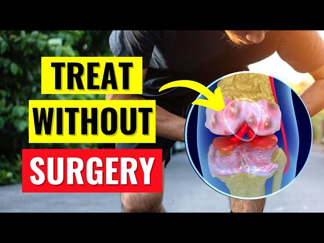 The Best Knee Arthritis Treatments Without Surgery