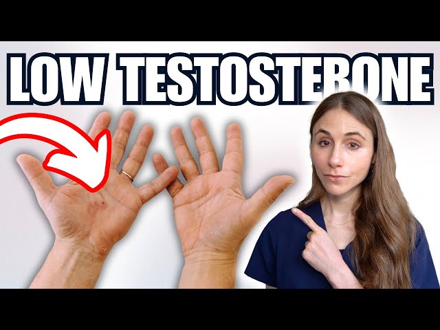 7 Warning Signs Of Low Testosterone NOT TO MISS (Skin, Hair, Nails)