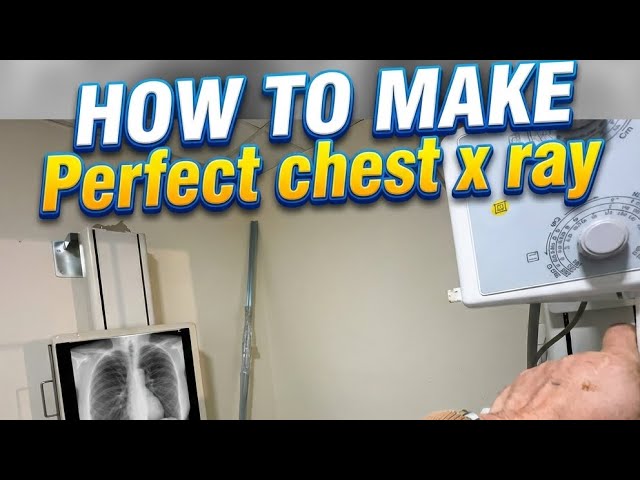 How to Perform a PERFECT PA Chest X -Ray