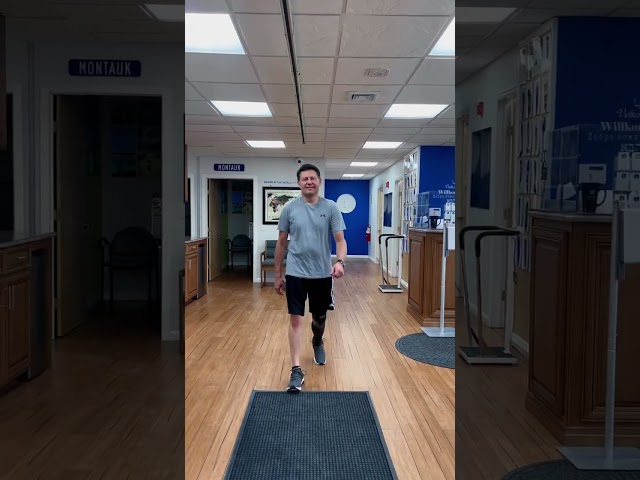 Customized 3D Printed Prosthetic Covers for Below-Knee Amputees