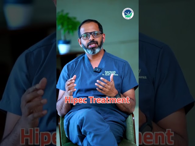 Treating peritoneal cavity cancers with HIPEC Surgery