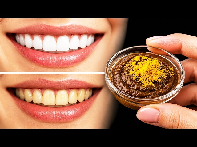 Dentists are silent about this! 🔥 Teeth whitening and tartar removal in 2 minutes!