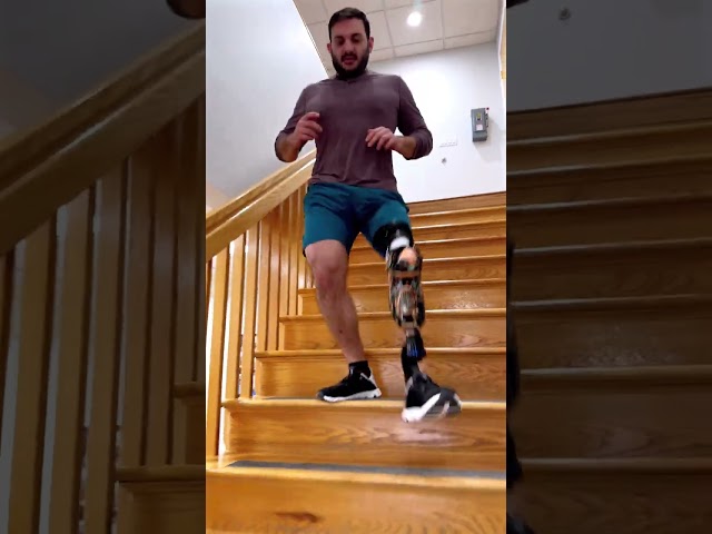 Gabriel, Workingout with Rotationplasty Prosthesis