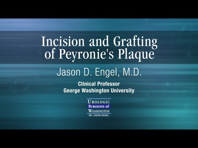 Peyronie's Disease Overview & Treatment