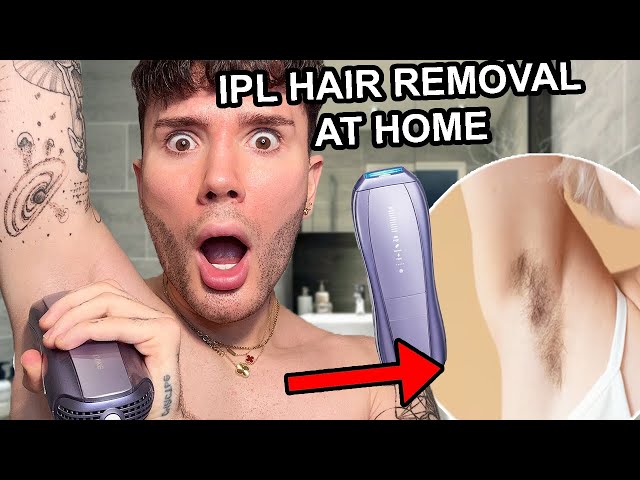 PREVENT INGROWN HAIRS WITH AT HOME LASER HAIR REMOVAL! {Ulike Air 10}