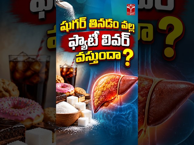 షుగర్ తినడం వల్ల ఫ్యాటీ లివర్ వస్తుందా ? | T-SAT